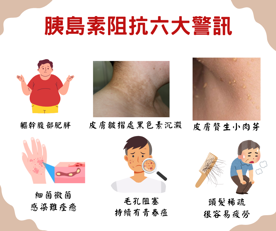 從代謝困境到瘦身突破：掌握胰島素阻抗的檢查與改善關鍵